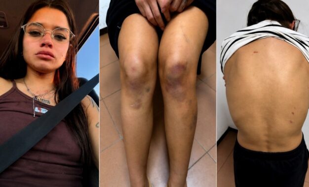 Qué dice el informe sobre las lesiones de Victoria Cantero, la joven detenida por matar a su novio en Chaco